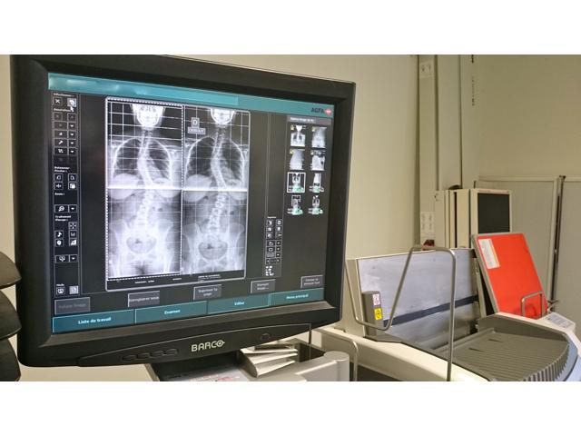 Photo A vendre Radiographie assistée par ordinateur (RAO) AGFA DX-M image 3/3