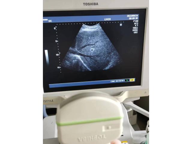 Photo Sonde echographe convexe philips image 3/5